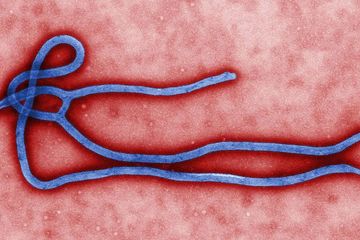 A microscopic view of the Ebola virus. Credit: CDC/Cynthia Goldsmith/Public Health Image Library